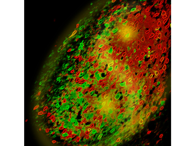 2_neurons-in-the-central-amygdala